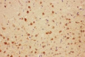 Anti-MAG antibody, IHC(P) IHC(P): Rat Brain Tissue (MAG antibody  (N-Term))
