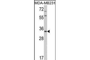 Western blot analysis of HPGD Antibody (C-term) (ABIN390765 and ABIN2841023) in MDA-M cell line lysates (35 μg/lane).