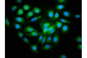 Immunofluorescence staining of A549 cells with ABIN7166112 at 1:200, counter-stained with DAPI. (SHISA5 antibody  (AA 56-137))