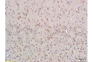 Formalin-fixed and paraffin embedded rat brain labeled with Anti-Nestin Polyclonal Antibody (ABIN723530), Unconjugated 1:300 followed by conjugation to the secondary antibody and DAB staining (Nestin antibody  (AA 681-750))