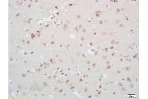 Formalin-fixed and paraffin embedded rabbit brain labeled with Rabbit Anti Phospho-NMDAR2B (Tyr1070) Polyclonal Antibody, Unconjugated (ABIN744353) at 1:200 followed by conjugation to the secondary antibody and DAB staining (GRIN2B antibody  (pTyr1070))