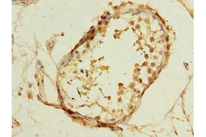 Immunohistochemistry of paraffin-embedded human testis tissue using ABIN7172942 at dilution of 1:100 (TM7SF3 antibody  (AA 22-295))