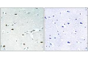 Immunohistochemistry analysis of paraffin-embedded human brain tissue, using Retinoblastoma (Ab-826) Antibody. (Retinoblastoma Protein (Rb) antibody  (AA 601-650))