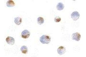 Immunocytochemical staining of K562 cells using Acinus antibody at 5μg/ml. (ACIN1 antibody  (Cytoplasmic Domain))