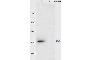 Lane 1: mouse testis lysates Lane 2: mouse lung lysates probed with Anti CTAG1B/Cancer/testis antigen 1 Polyclonal Antibody, Unconjugated (ABIN1385261) at 1:200 in 4 °C. (CTAG1B antibody  (AA 81-180))
