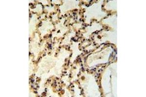 Immunohistochemistry analysis in formalin fixed and paraffin embedded rat lung tisssue reacted with IMMP2L Antibody (Center) followed by peroxidase conjugation of the secondary antibody and DAB staining. (IMMP2L antibody  (Middle Region))