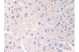 Detection of ADRP in Human Liver Tissue using Polyclonal Antibody to Adipose Differentiation Related Protein (ADRP) (ADRP antibody  (AA 245-433))