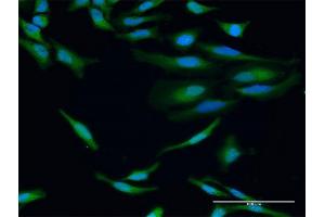 Immunofluorescence of purified MaxPab antibody to IGHG1 on HeLa cell. (IGHG1 antibody  (AA 1-469))