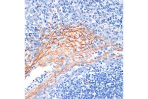 Immunohistochemistry of paraffin-embedded human tonsil using AREG antibody (ABIN6127431, ABIN6137065, ABIN6137066 and ABIN6216408) at dilution of 1:100 (40x lens). (Amphiregulin antibody  (AA 20-252))