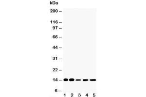 Western blot testing of FABP1 antibody and Lane 1:  rat liver;  2: rat kidney;  3: HeLa;  4: (mouse) Neuro-2a;  5: (human) SMMC-7721 cell lysate (FABP1 (liver) antibody  (N-Term))