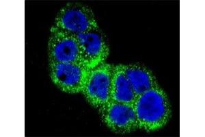 Confocal immunofluorescent analysis of IGF1R antibody with WiDr cells followed by Alexa Fluor 488-conjugated goat anti-rabbit lgG (green). (IGF1R antibody  (AA 51-77))