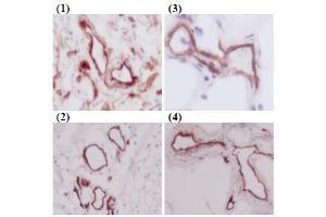 Immunohistochemistry (IHC) image for anti-CD93 (CD93) antibody (ABIN1449221) (CD93 antibody)