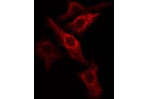 ABIN6274786 staining COLO205 cells by IF/ICC. (PGLS antibody  (C-Term))
