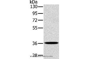 Western blot analysis of A172 cell, using PDLIM1 Polyclonal Antibody at dilution of 1:400 (PDLIM1 antibody)