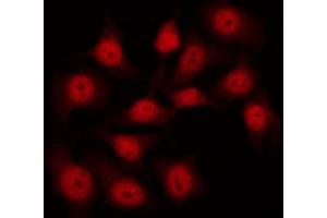 Immunofluorescence (fixed cells) (IF/ICC) image for anti-Filamin A, alpha (FLNA) (pSer2152) antibody (ABIN6256196)