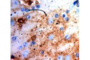 IHC-P analysis of Brain tissue, with DAB staining. (PHPT1 antibody  (AA 1-124))