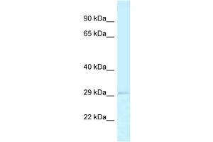 WB Suggested Anti-RPA2 Antibody Titration: 1. (RPA2 antibody  (N-Term))