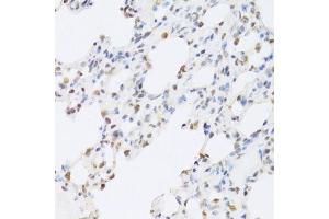 Immunohistochemistry of paraffin-embedded rat lung using SFN Antibody. (14-3-3 sigma/SFN antibody  (AA 1-248))