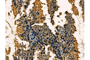 ABIN6263783 and ABIN6266750 at 1/100 staining Mouse testis tissue by IHC-P. (NXF1 antibody  (N-Term))
