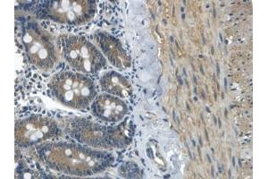 Immunohistochemistry (IHC) image for anti-Apolipoprotein B (APOB) (AA 2747-2913) antibody (ABIN7429130)