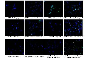 Immunofluorescence staining of 293F cells and 293F transfected cells with Company A, Company B, Company C, Company D, Company E, ABIN7193151 at 1:100, counter-stained with DAPI. (HA-Tag antibody)