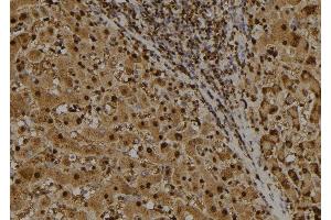 ABIN6277717 at 1/100 staining Human liver tissue by IHC-P. (IRF7 antibody  (C-Term))