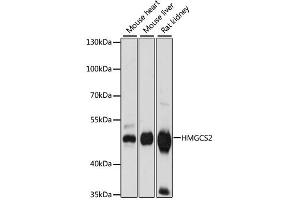 Western blot analysis of extracts of various cell lines, using HMGCS2 antibody (ABIN6292123) at 1:1000 dilution. (HMGCS2 antibody)
