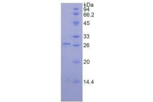 SDS-PAGE analysis of Mouse Proteinase 3 Protein. (PRTN3 Protein)