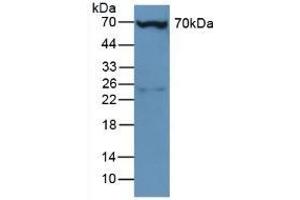 Detection of PLS3 in Mouse Liver Tissue using Polyclonal Antibody to Plastin 3 (PLS3)