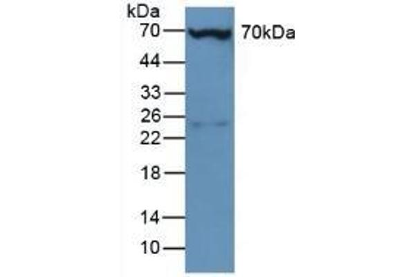 Plastin 3 抗体  (AA 5-251)