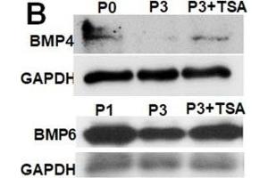 TSA rescues BMP expression in SKPs.