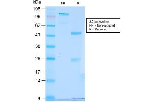 SDS-PAGE Analysis Purified pS2 Rabbit Recombinant Monoclonal Antibody (TFF1/2969R). (Recombinant TFF1 antibody  (AA 57-84))