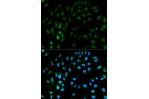 Immunofluorescence analysis of MCF-7 cells using TFPI antibody. (TFPI antibody)