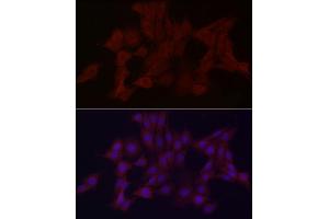 Immunofluorescence analysis of PC-12 cells using WDR45 Rabbit pAb (ABIN6133064, ABIN6150194, ABIN6150195 and ABIN6223490) at dilution of 1:100 (40x lens).