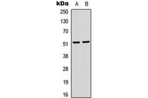 Western blot analysis of SRF (pS103) expression in HeLa (A), Jurkat (B) whole cell lysates.