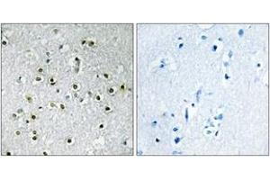 Immunohistochemistry (IHC) image for anti-Transcription Factor E3 (TFE3) (AA 101-150) antibody (ABIN2889417) (TFE3 antibody  (AA 101-150))
