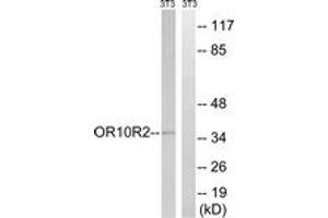 Western blot analysis of extracts from NIH-3T3 cells, using MAGEA5 Antibody. (MAGEA5 antibody  (AA 68-117))