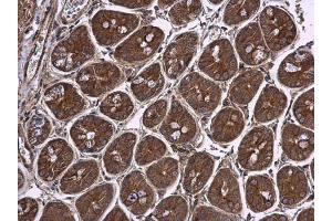 IHC-P Image Pyruvate Dehydrogenase E1 beta subunit antibody detects Pyruvate Dehydrogenase E1 beta subunit protein at cytoplasm in mouse intestine by immunohistochemical analysis. (PDHE1-B antibody)