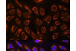 Immunofluorescence analysis of U-2 OS cells using GANAB Polyclonal Antibody at dilution of 1:100. (GANAB antibody)