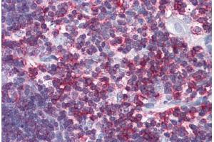 Human Thymus (formalin-fixed, paraffin-embedded) stained with CD45 antibody ABIN337379 at 10 ug/ml followed by biotinylated goat anti-rabbit IgG secondary antibody ABIN481713, alkaline phosphatase-streptavidin and chromogen. (CD45 antibody  (C-Term))