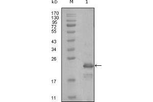 Western blot analysis using HAND1 mouse mAb against truncated Trx-HAND1 recombinant protein (1). (HAND1 antibody  (AA 90-190))