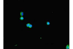 Immunofluorescent analysis of HepG2 cells using ABIN7150849 at dilution of 1:100 and Alexa Fluor 488-congugated AffiniPure Goat Anti-Rabbit IgG(H+L) (DNAAF3 antibody  (AA 1-209))