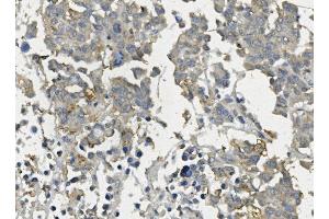 IHC analysis of Claudin 3/CLDN3 using anti-Claudin 3/CLDN3 antibody (ABIN7602816).