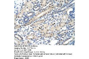 Human kidney (NAC1 antibody  (C-Term))