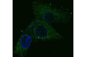 Immunofluorescence (IF) image for anti-Met Proto-Oncogene (MET) antibody (ABIN2995275)