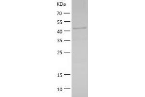 Western Blotting (WB) image for GA-Binding Protein Subunit beta-2 (GABPB2) (AA 1-395) protein (His tag) (ABIN7286980) (GABPB2 Protein (AA 1-395) (His tag))