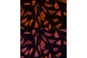 Immunofluorescence analysis of L929 cells using GOLPH3 antibody (ABIN6131711, ABIN6141272, ABIN6141273 and ABIN6216996) at dilution of 1:100. (GOLPH3 antibody  (AA 1-298))