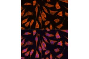 Immunofluorescence analysis of L929 cells using GOLPH3 antibody (ABIN6131711, ABIN6141272, ABIN6141273 and ABIN6216996) at dilution of 1:100. (GOLPH3 antibody  (AA 1-298))