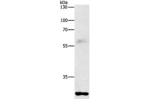Western Blot analysis of Mouse lung tissue using FGF2 Polyclonal Antibody at dilution of 1:1000 (FGF2 antibody)