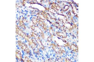 Immunohistochemistry of paraffin-embedded rat kidney using Bcl-XL Rabbit pAb (ABIN3020685, ABIN3020686, ABIN1512625 and ABIN6213668) at dilution of 1:100 (40x lens). (BCL2L1 antibody  (AA 1-120))